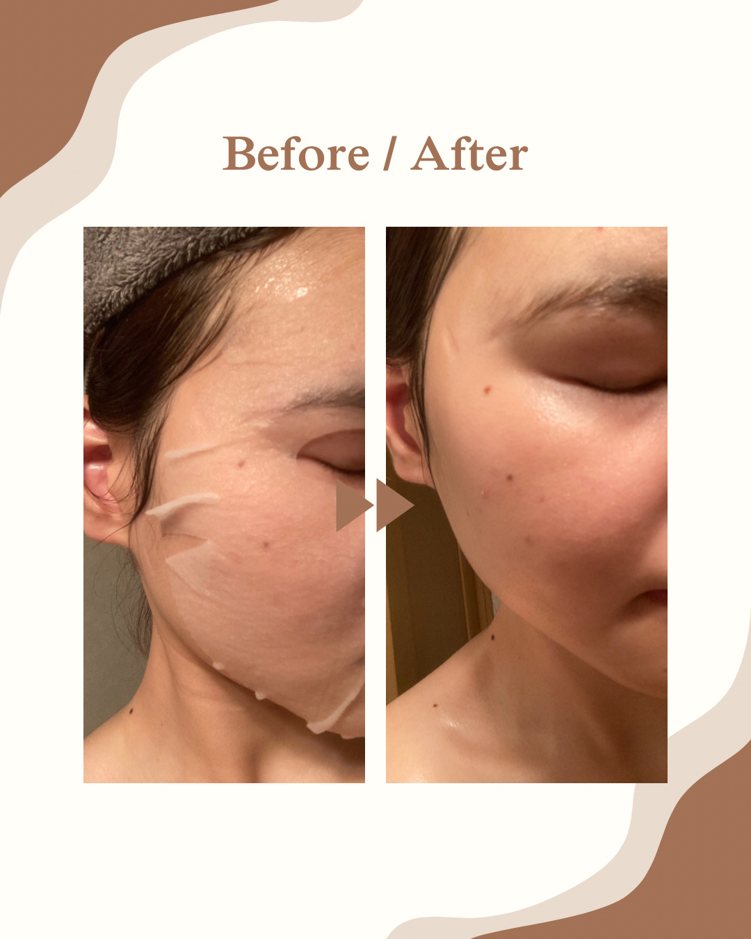 ごめんね素肌マスク/クリアターン/シートマスク・パックを使ったクチコミ（2枚目）