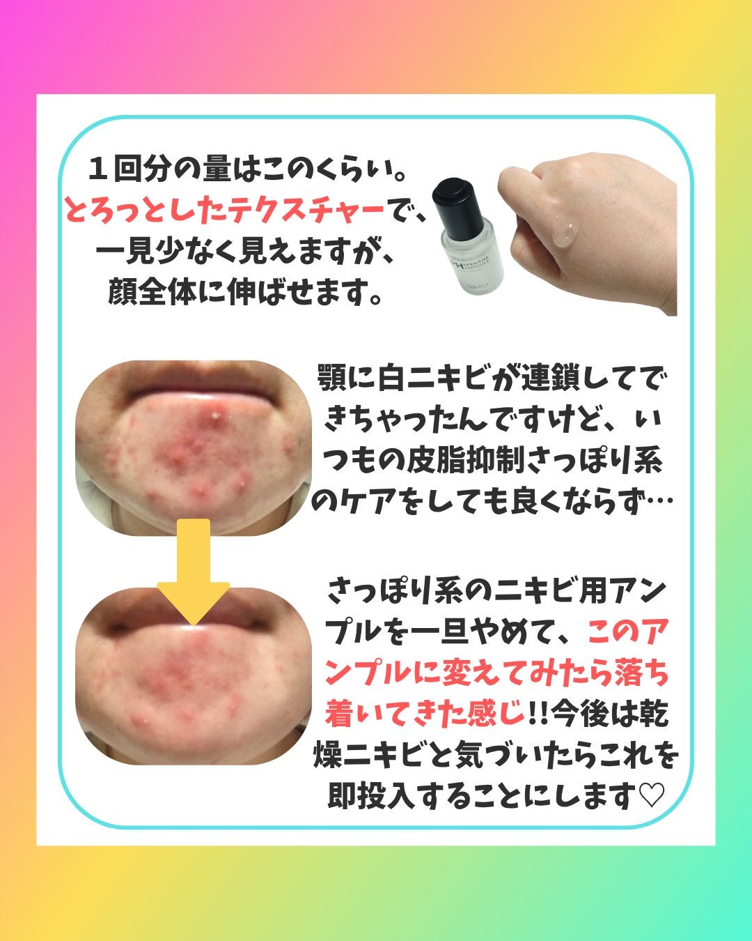 PHセンシティブアンプル/SAM'U/美容液を使ったクチコミ(4枚目)