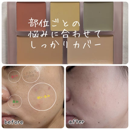 コンシールブレンダーパレット/LUNA/パレットコンシーラーを使ったクチコミ(4枚目)