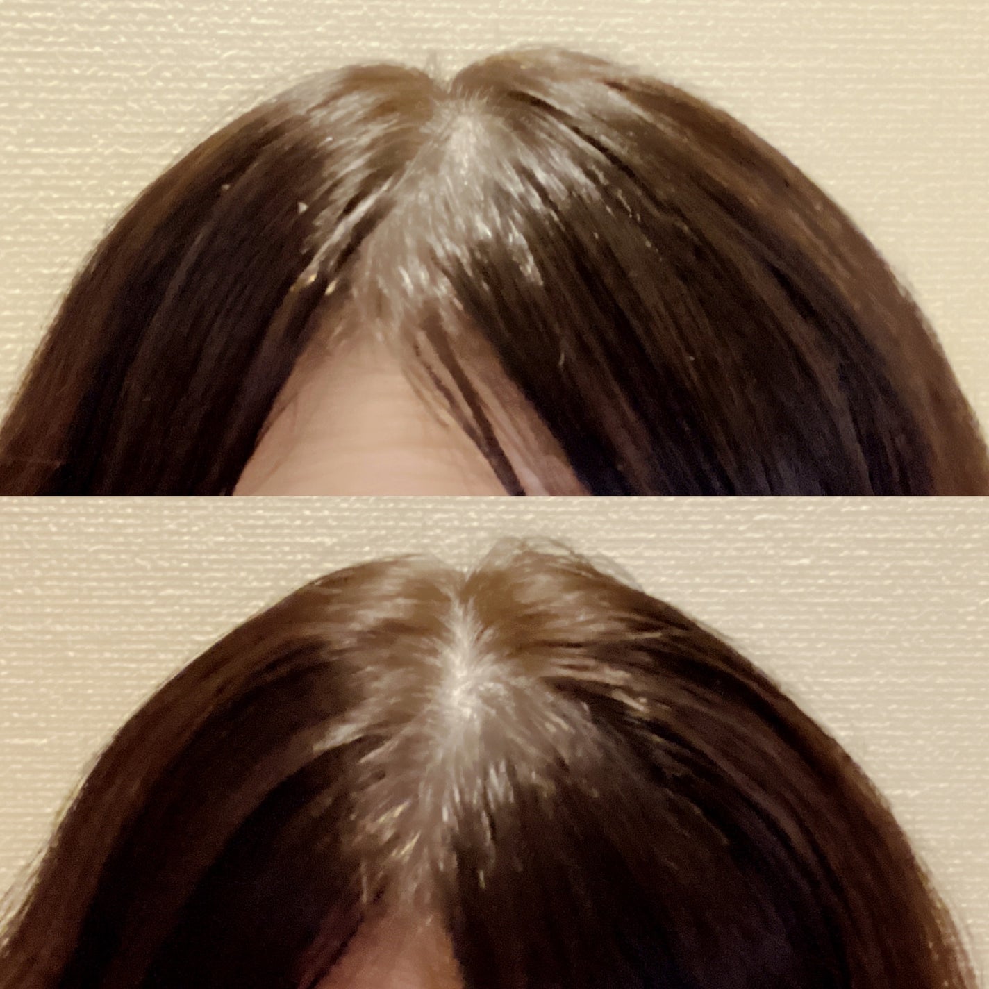 ヘアニードルセラム/REPAIR SHOOTER/頭皮ローションを使ったクチコミ(4枚目)