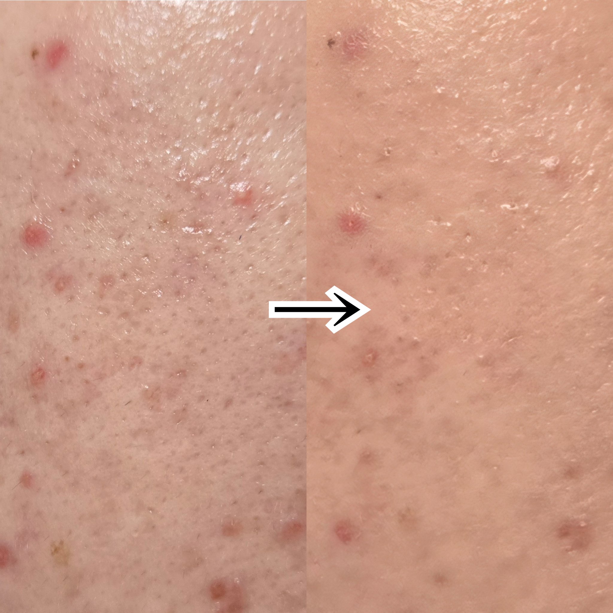 コンフォートスキン　ウェア/KANEBO/リキッドファンデーションを使ったクチコミ（3枚目）