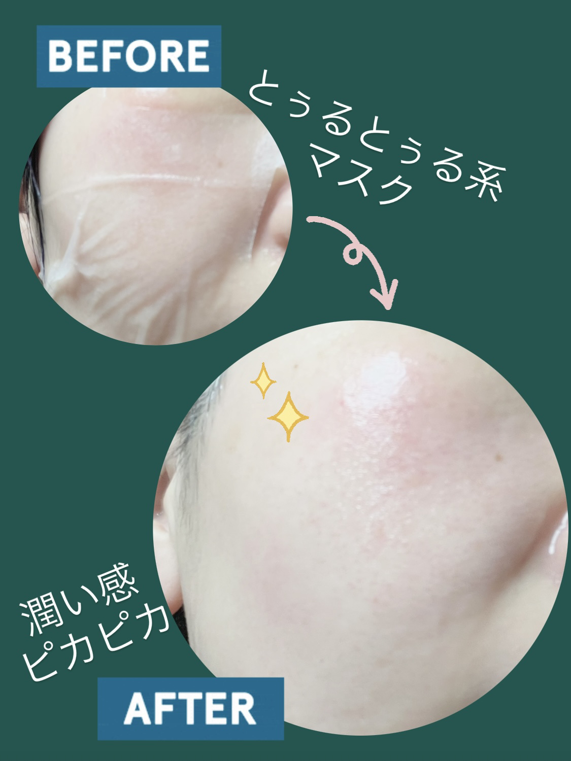 モイスチャートリートメントマスク/celq:ne/シートマスク・パックを使ったクチコミ（2枚目）