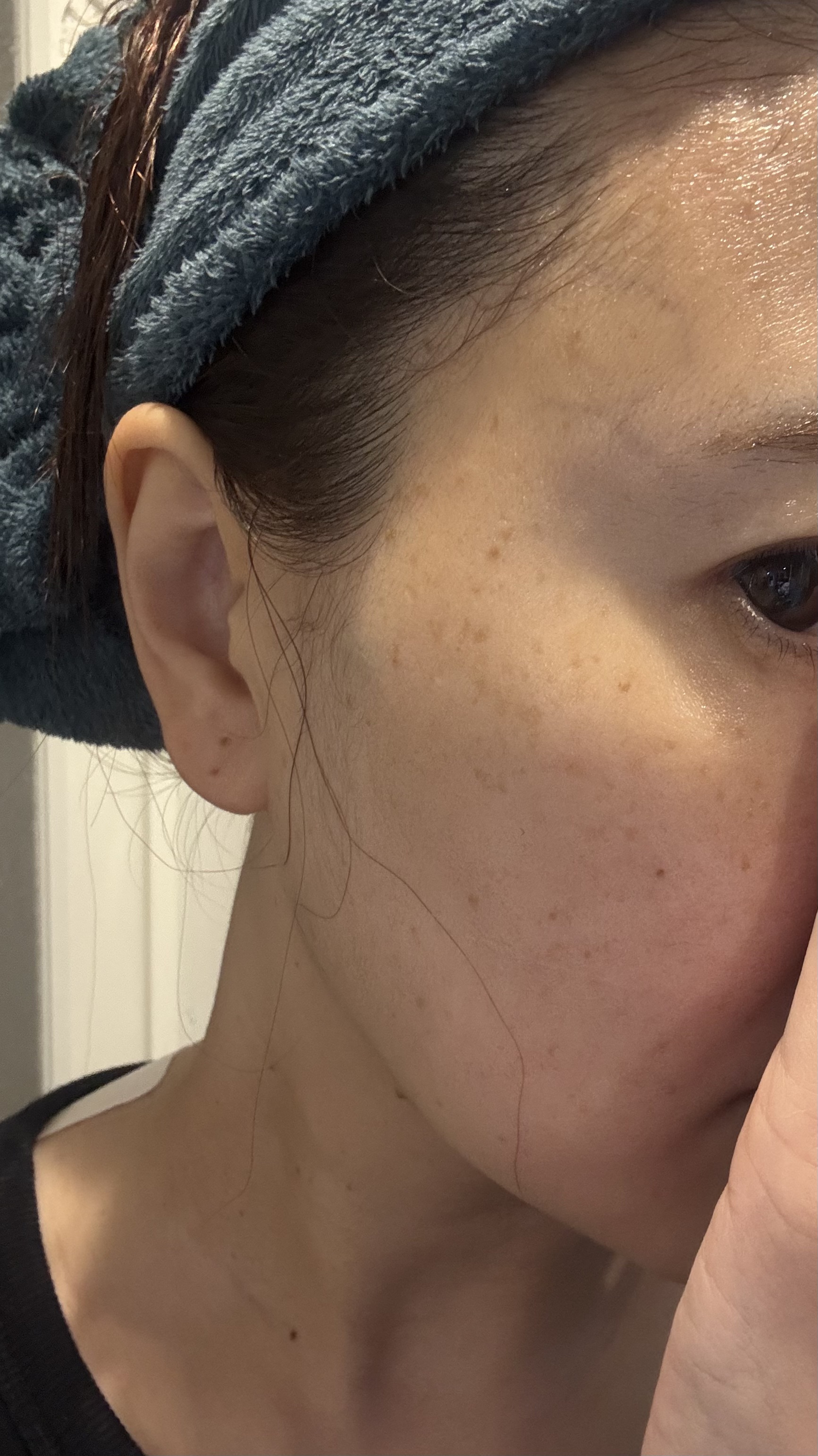 super power mask/AROCELL/シートマスク・パックを使ったクチコミ（3枚目）