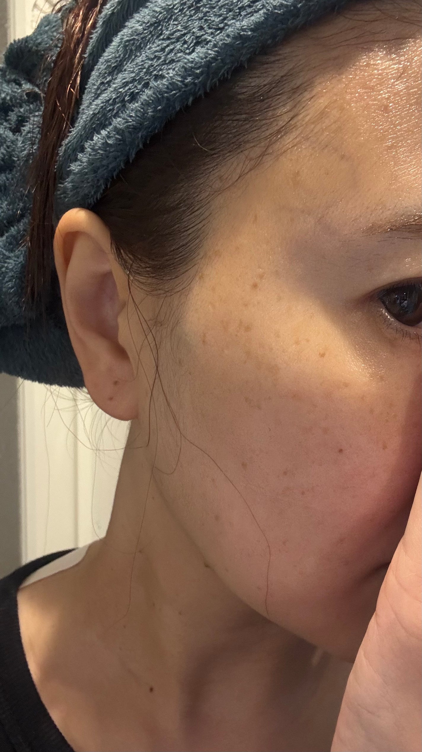 super power mask/AROCELL/シートマスク・パックを使ったクチコミ(3枚目)