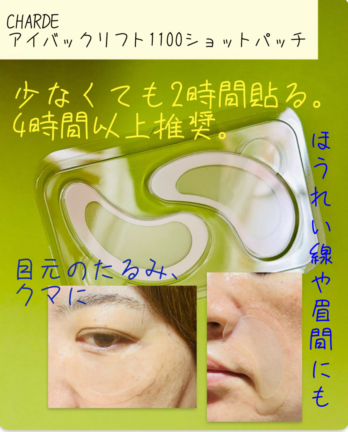 アイバックリフト1100シャットリードルパッチ/CHARDE/シートマスク・パックを使ったクチコミ（3枚目）