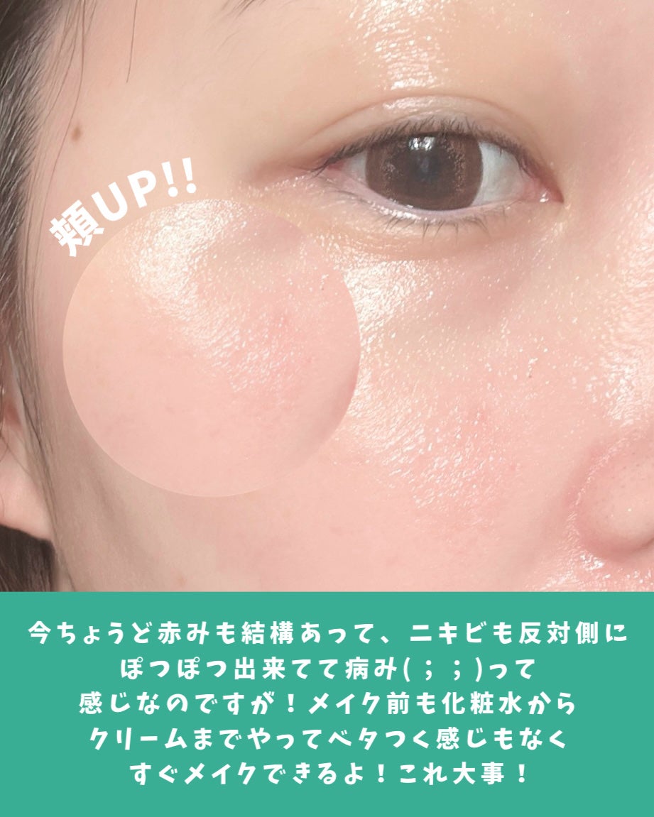 ダーマジェンシー ゼロカ86 トナー/DERMAGENCY/化粧水を使ったクチコミ(6枚目)