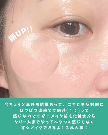 ダーマジェンシー ゼロカ86 トナー/DERMAGENCY/化粧水を使ったクチコミ(6枚目)