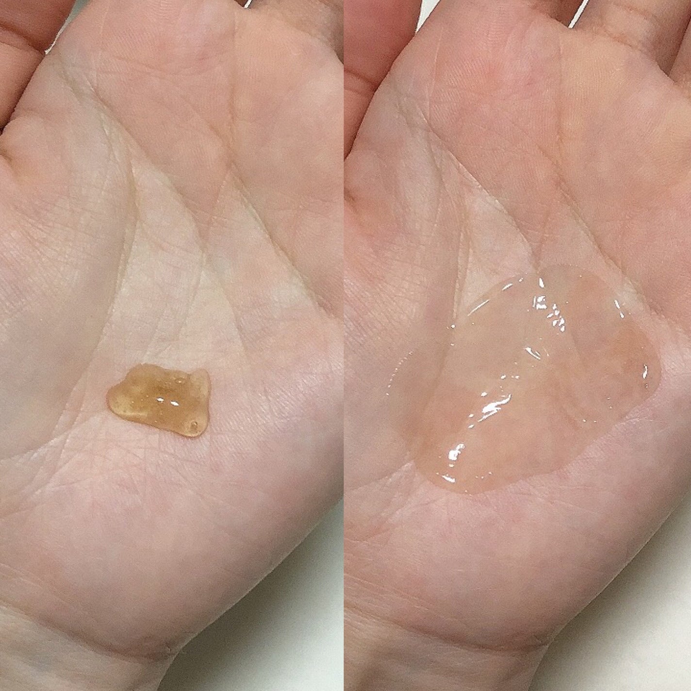 360度ショットPDRNアクティブセラム/センテリアン24/美容液を使ったクチコミ(5枚目)