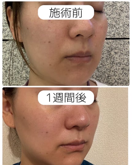 を使ったクチコミ(2枚目)