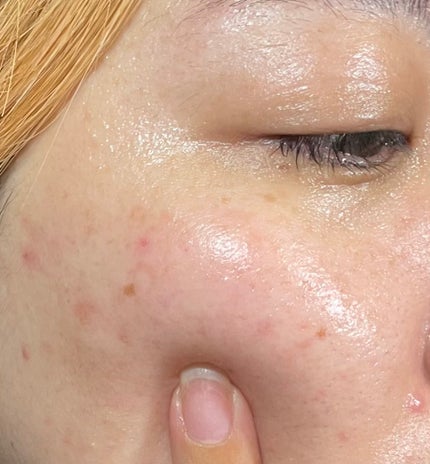 PDRN カプセルクリーム 100/VT/フェイスクリームを使ったクチコミ(6枚目)