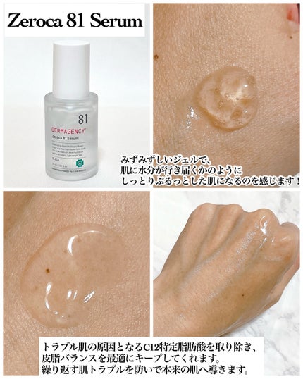 ダーマジェンシー ゼロカ86 トナー/DERMAGENCY/化粧水を使ったクチコミ(3枚目)