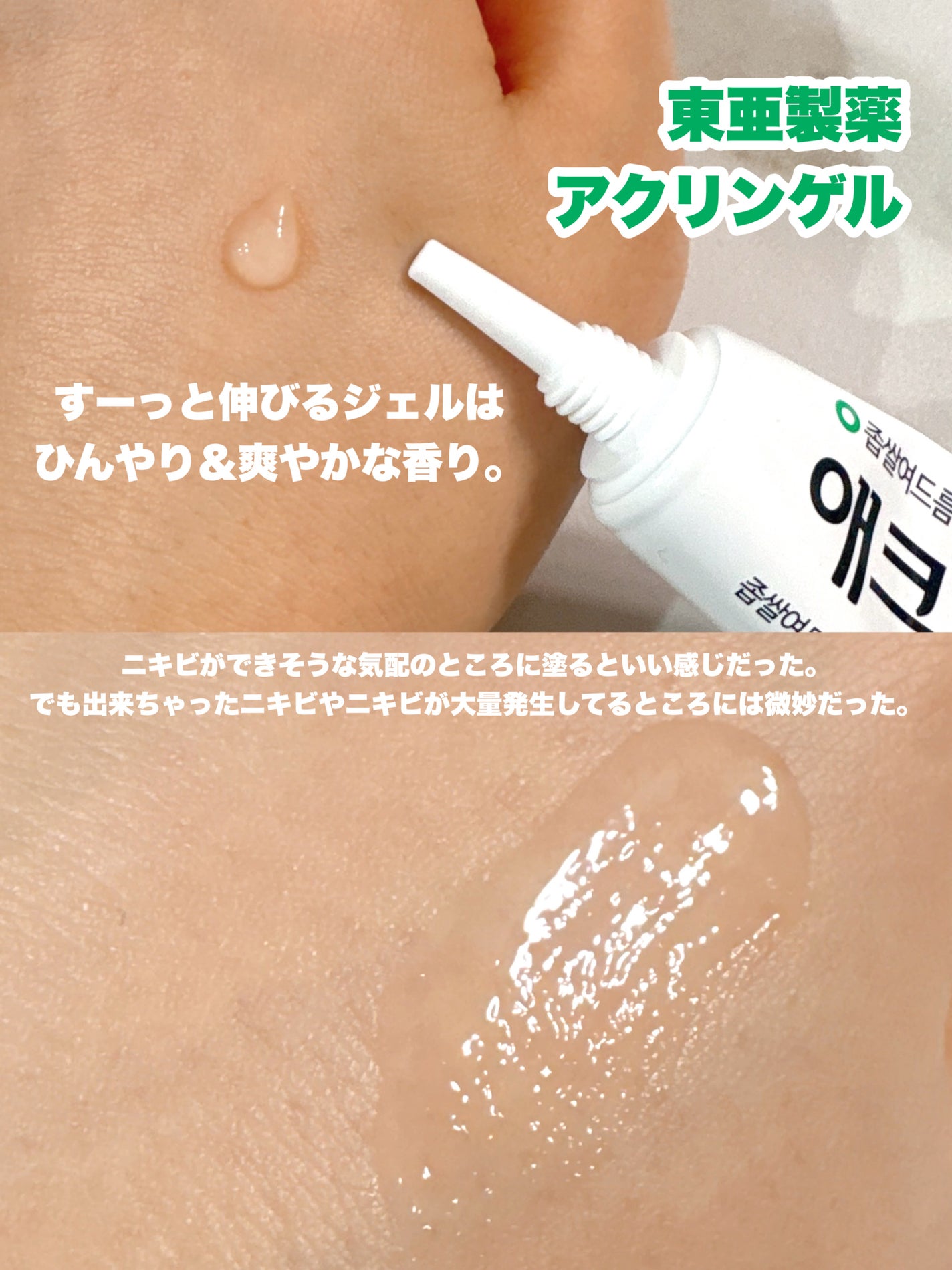 アクリンゲル/東亜製薬/その他スキンケアを使ったクチコミ(2枚目)