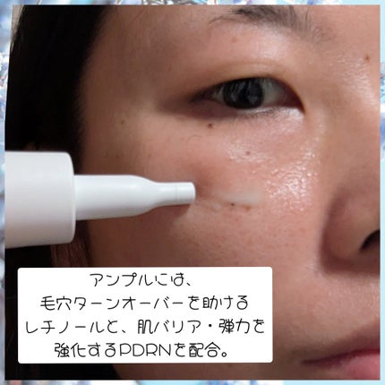 ReDRNエクソソームアンプル/Dr.nineteen/美容液を使ったクチコミ(2枚目)