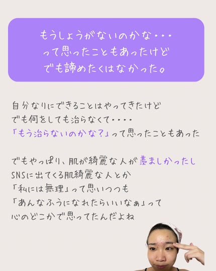 ãŸããð±èèãæ¹åã€ã³ããŒã±ã¢ on LIPS ããããªæ©ã¿ãããŸãããïŒâ¬ïžâ©ã¹ãã³ã±ã¢ããŠãã®ã«ã»ã»ã»âšç®è..ãïŒ4æç®ïŒ