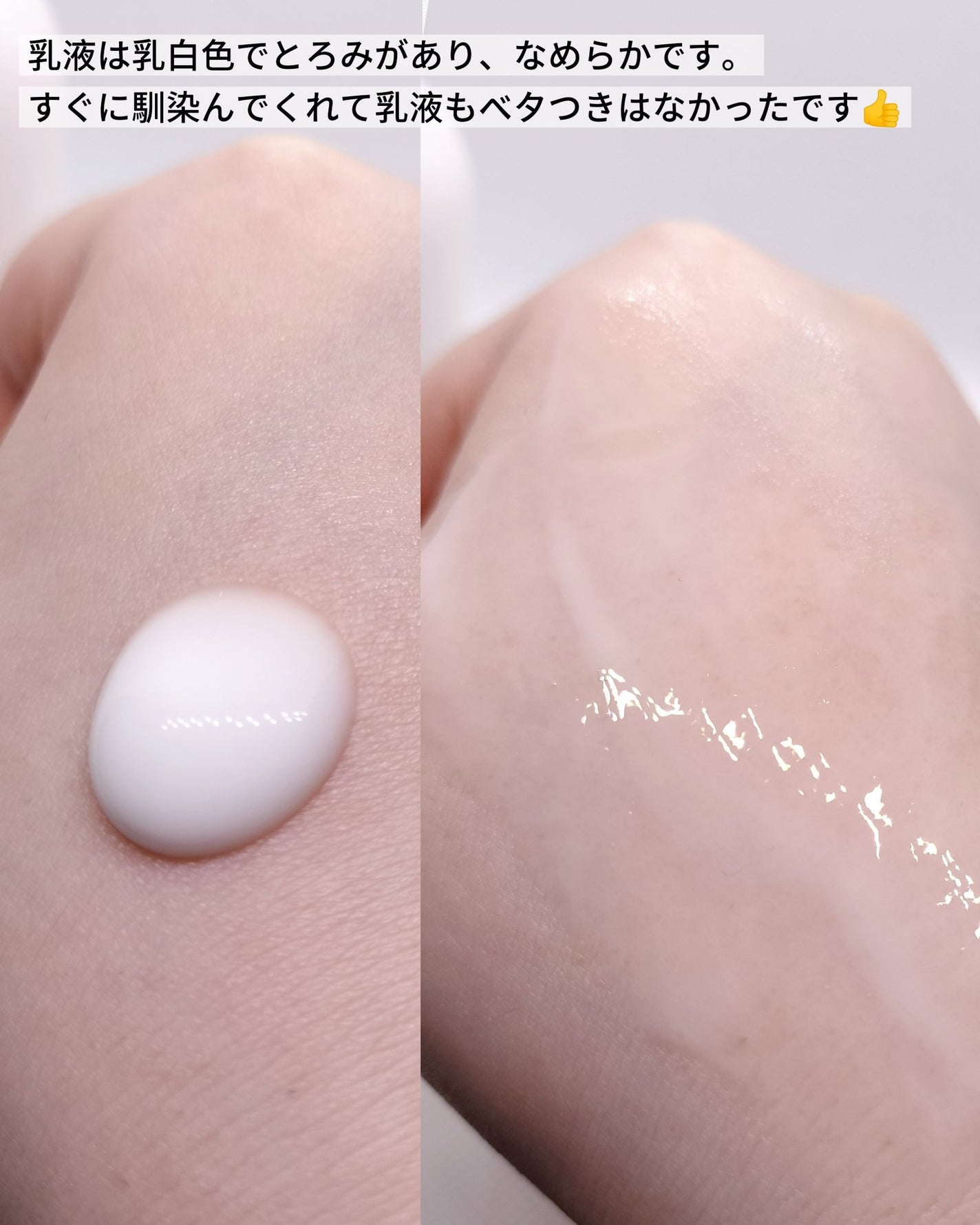 薬用ローション(とてもしっとり)/IHADA/化粧水を使ったクチコミ(5枚目)