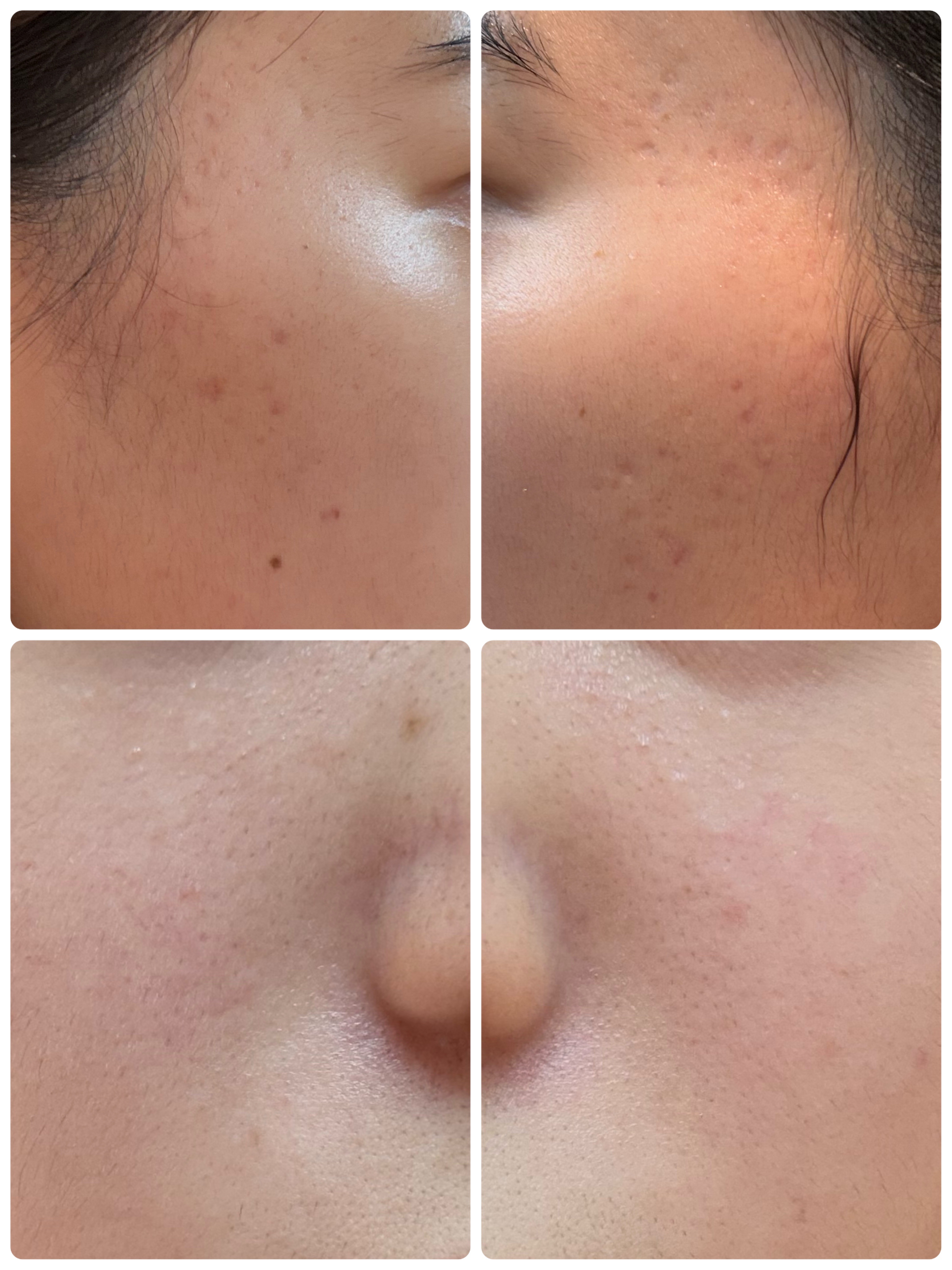 ブラックヘッドバームスクラブ/オブジェ/フェイスバームを使ったクチコミ（2枚目）