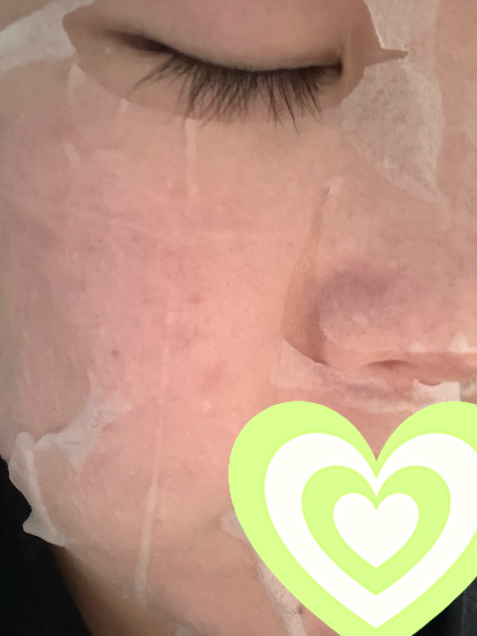 レチビタエッセンスマスク/ピュレア/シートマスク・パックを使ったクチコミ（3枚目）