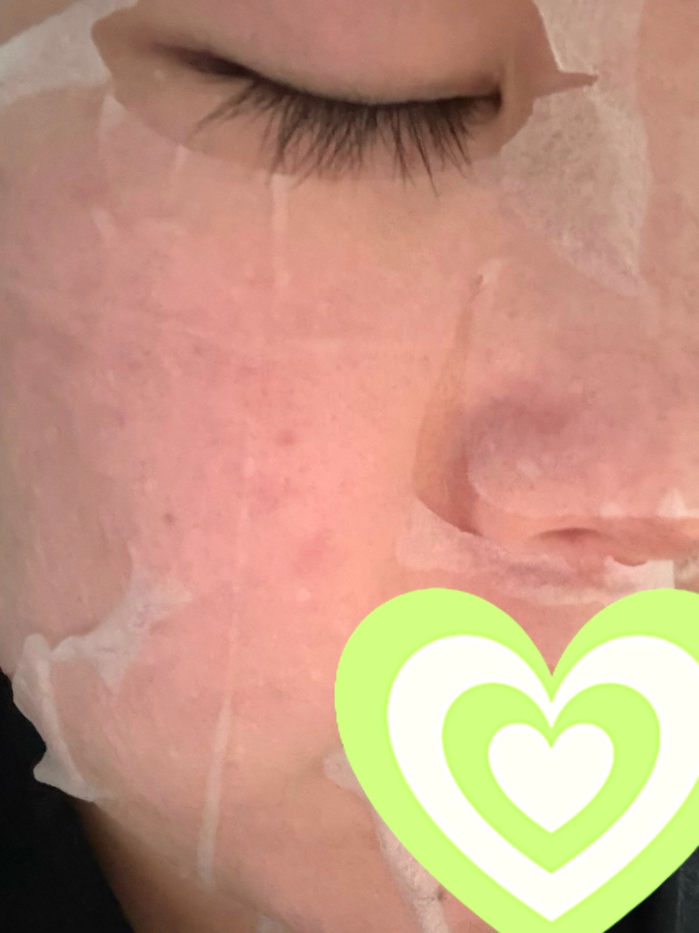 レチビタエッセンスマスク/ピュレア/シートマスク・パックを使ったクチコミ(3枚目)