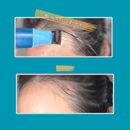 Scalp Root Calm & Barrier(コンブ一体型+リフィル セット)/ANDKWAN/スカルプブラシを使ったクチコミ(3枚目)