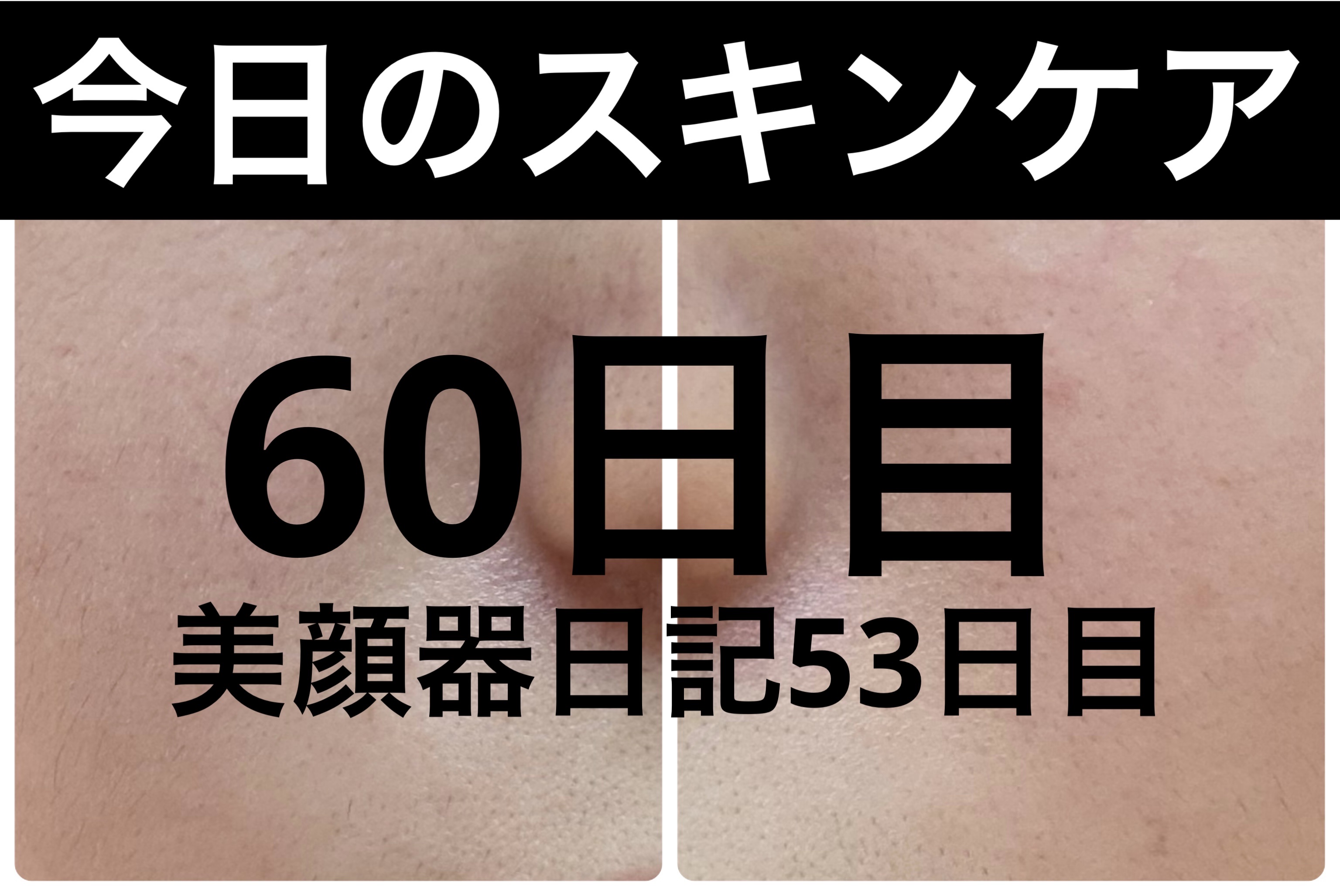 ブラックヘッドバームスクラブ/オブジェ/フェイスバームを使ったクチコミ（1枚目）