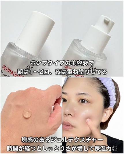 ダーマジェンシー ゼロカ86 トナー/DERMAGENCY/化粧水を使ったクチコミ(6枚目)