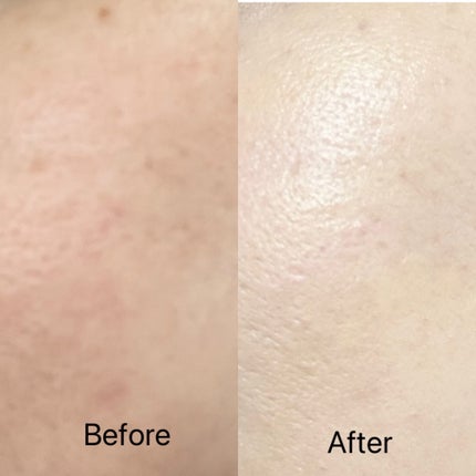 SIGNATURE ESSENCE COVER PACT /AGE20’s/クリーム・エマルジョンファンデーションを使ったクチコミ(7枚目)