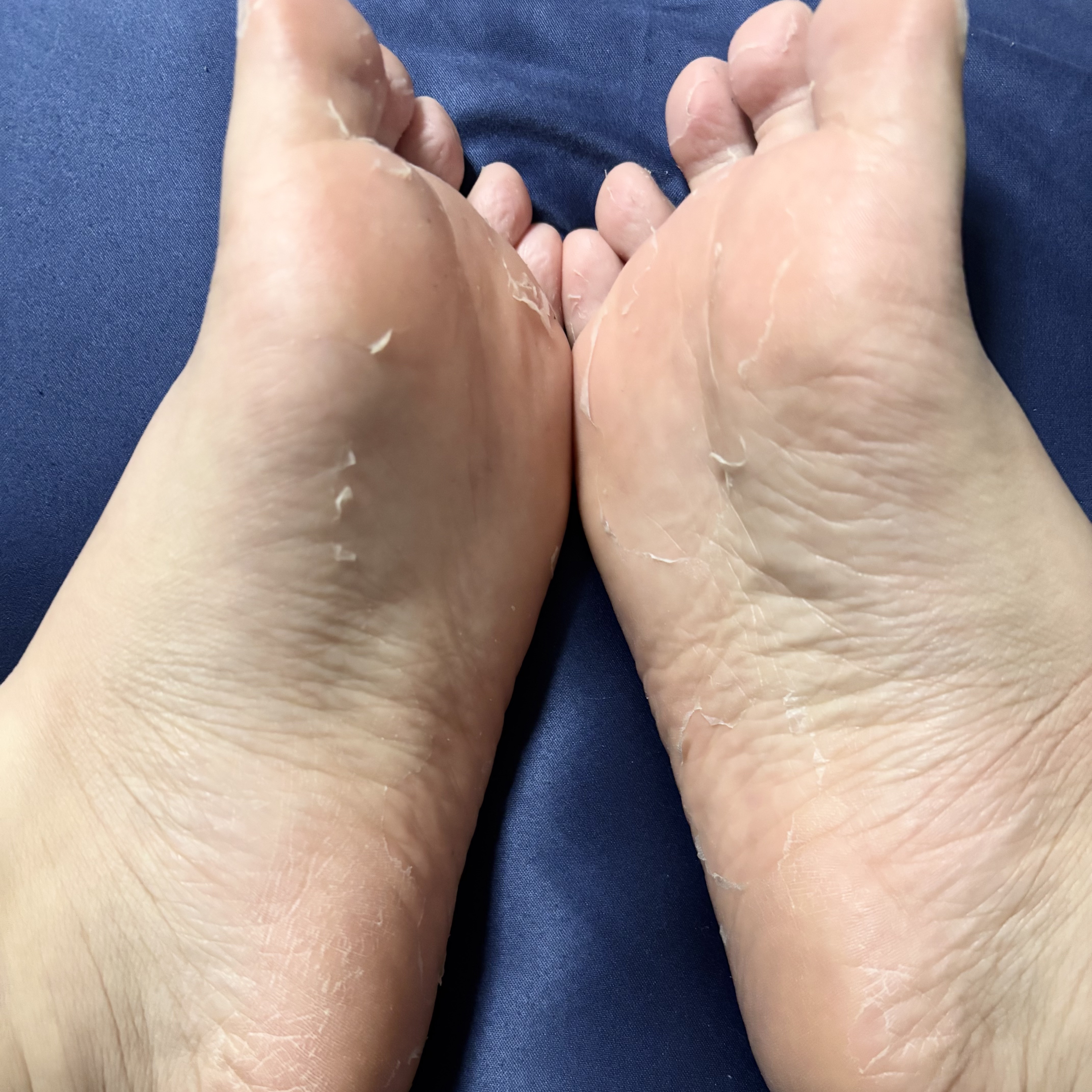 ましゅまろ素足/ピコモンテ/レッグ・フットケアを使ったクチコミ（2枚目）