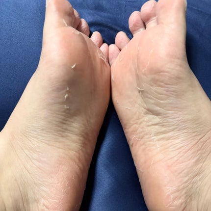ましゅまろ素足/ピコモンテ/レッグ・フットケアを使ったクチコミ(2枚目)