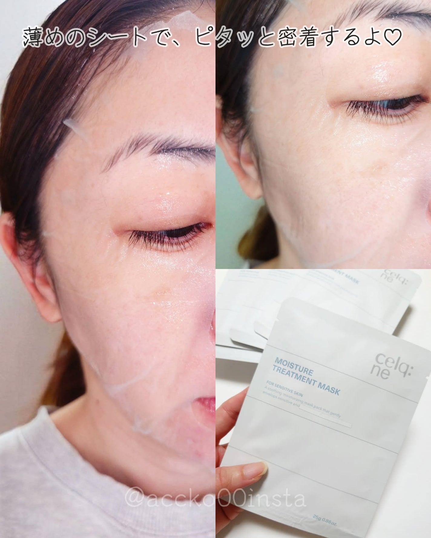 モイスチャートリートメントクリーム/celq:ne/フェイスクリームを使ったクチコミ(8枚目)