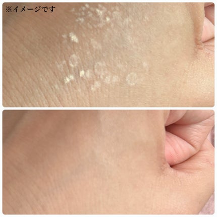 スキンケアフェイスパウダー/EVERYYOU/ルースパウダーを使ったクチコミ(5枚目)