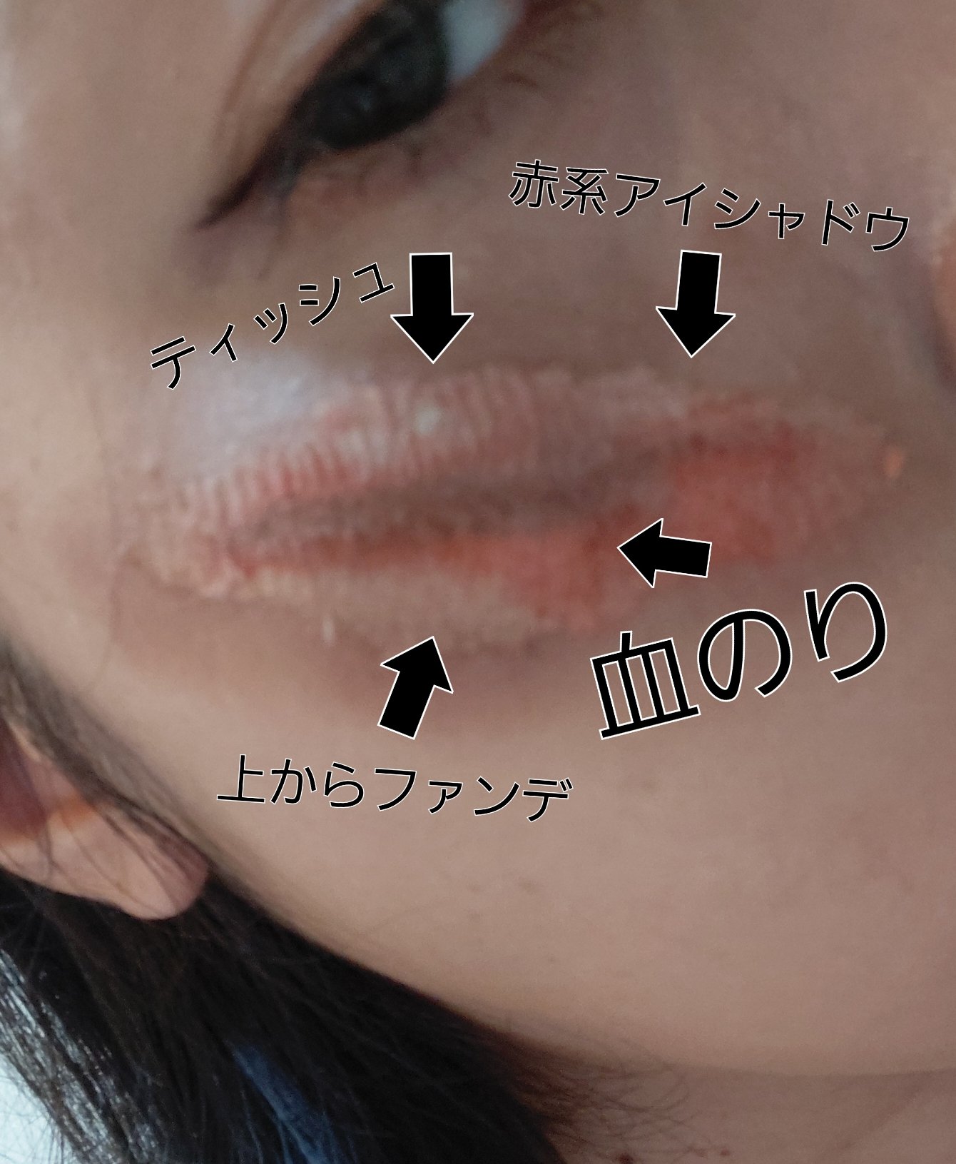 アイラッシュフィクサーEX 552/D-UP/つけまつげを使ったクチコミ（2枚目）