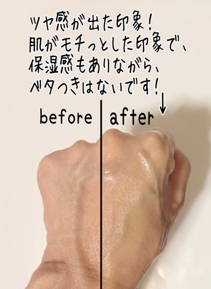 サミュ PHセンシティブフェイシャルトリートメント/SAM'U/美容液を使ったクチコミ(5枚目)