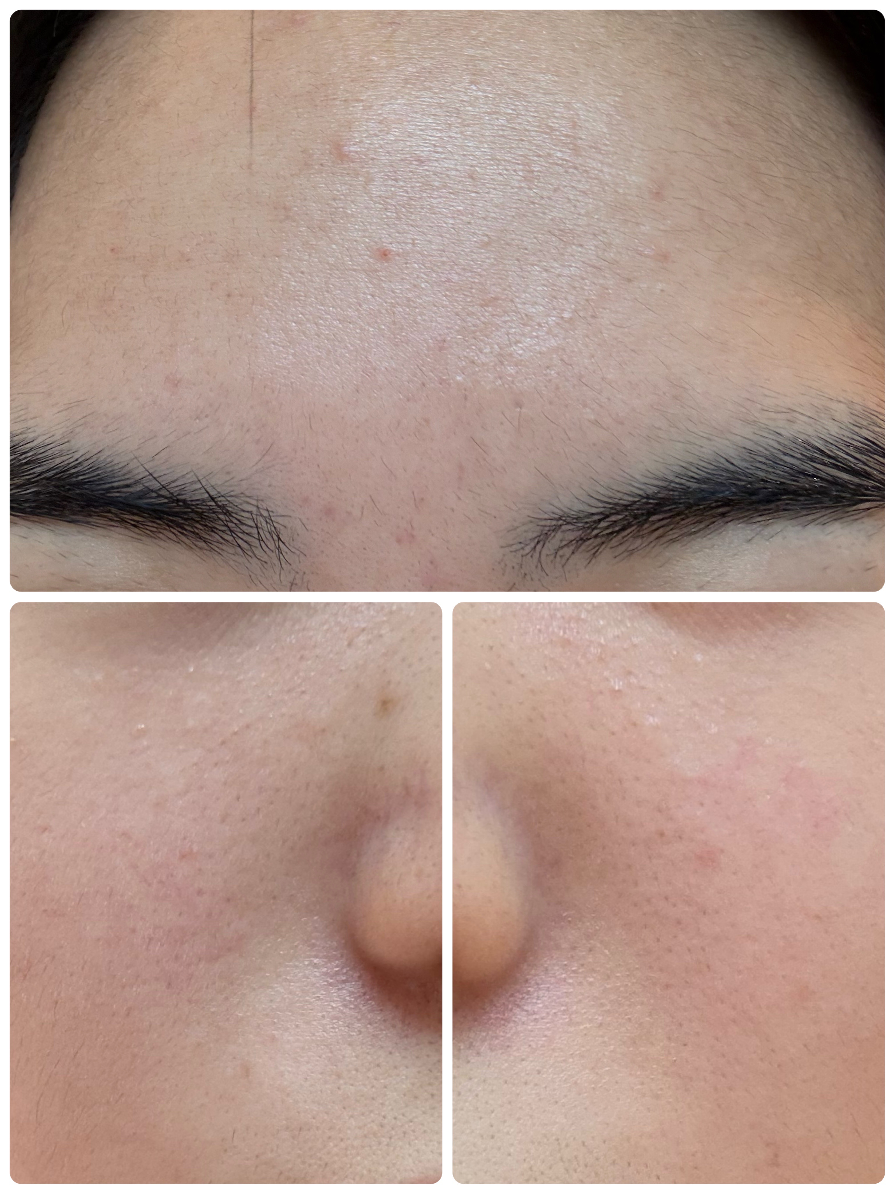 ブラックヘッドバームスクラブ/オブジェ/フェイスバームを使ったクチコミ（3枚目）