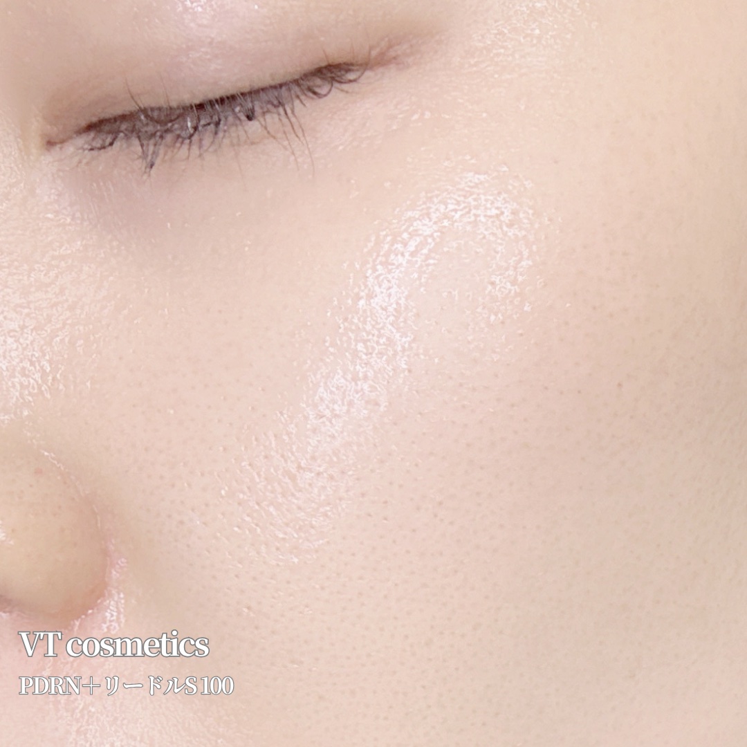 PDRN+リードルS 100/VT/美容液を使ったクチコミ（3枚目）