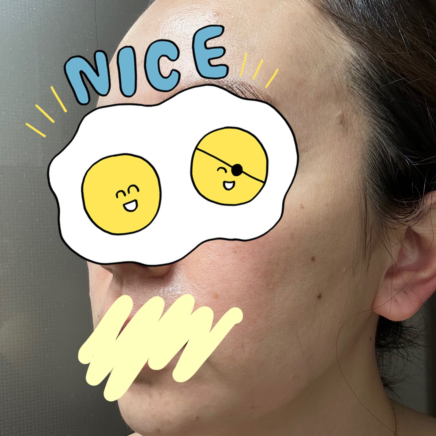 復活草シートマスクデイリーピック/Abib /シートマスク・パックを使ったクチコミ(4枚目)