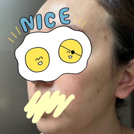 復活草シートマスクデイリーピック/Abib /シートマスク・パックを使ったクチコミ(4枚目)