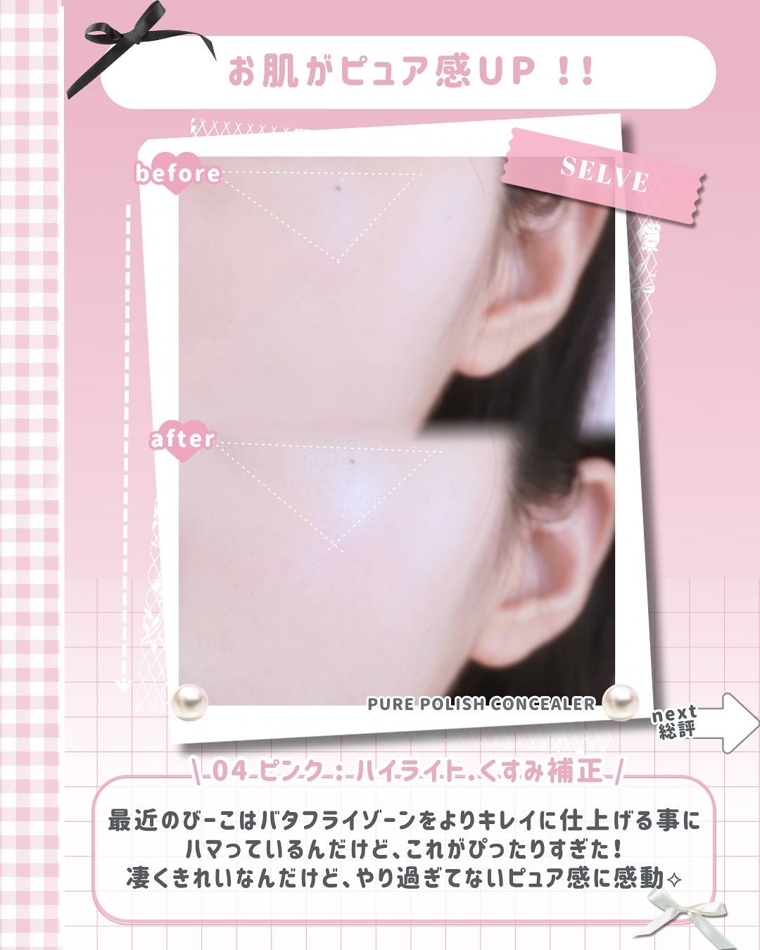 ピュアポリッシュコンシーラー/SELVE/リキッドコンシーラーを使ったクチコミ(5枚目)