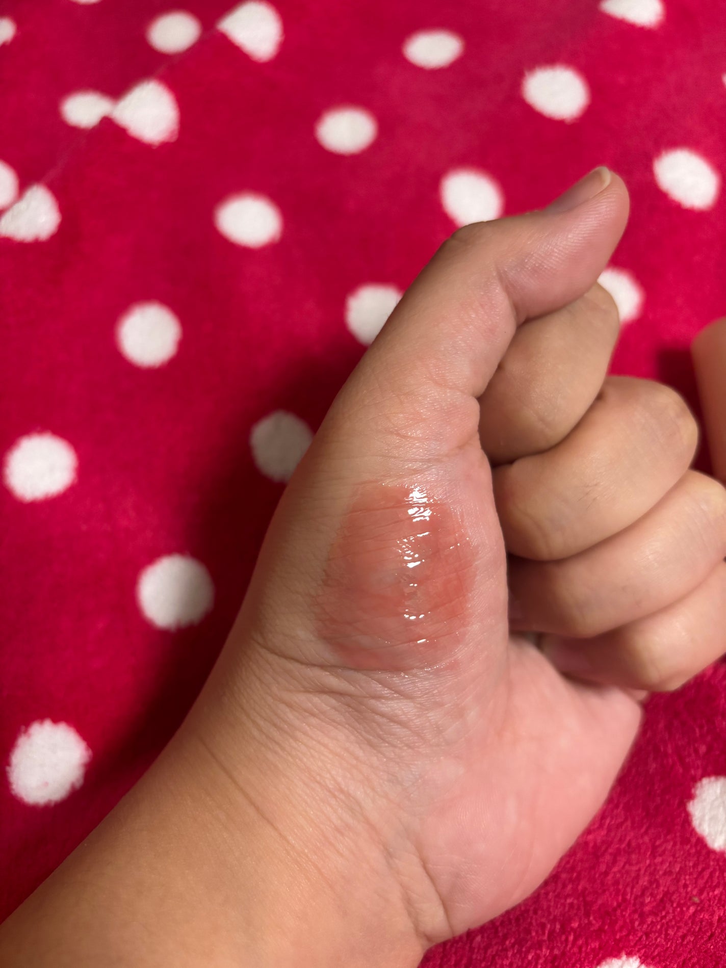 フィー 3Dボリューミンググロス/fwee/リップグロスを使ったクチコミ(10枚目)