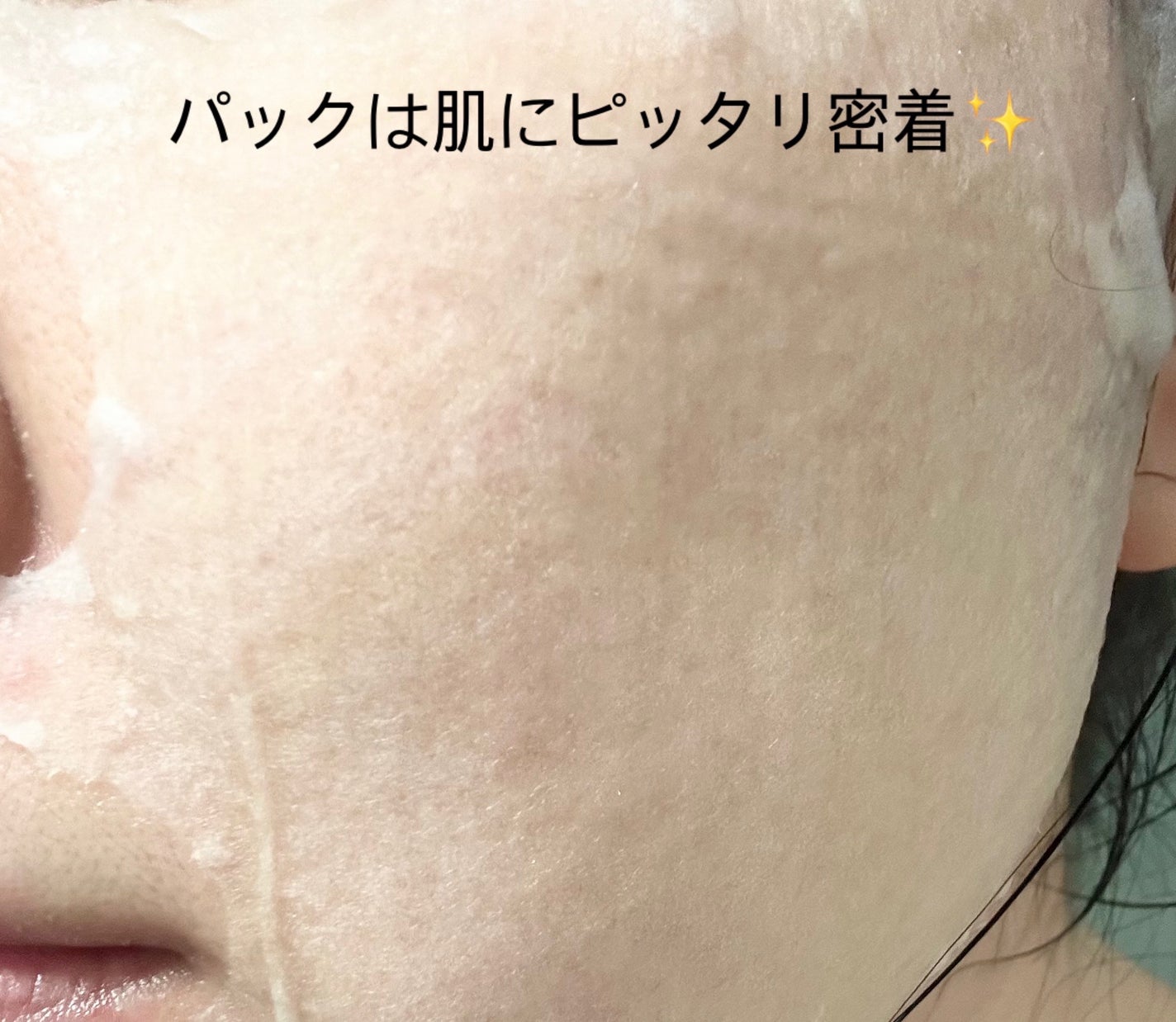 ドクダミシートマスクデイリーピック/Abib /シートマスク・パックを使ったクチコミ(3枚目)