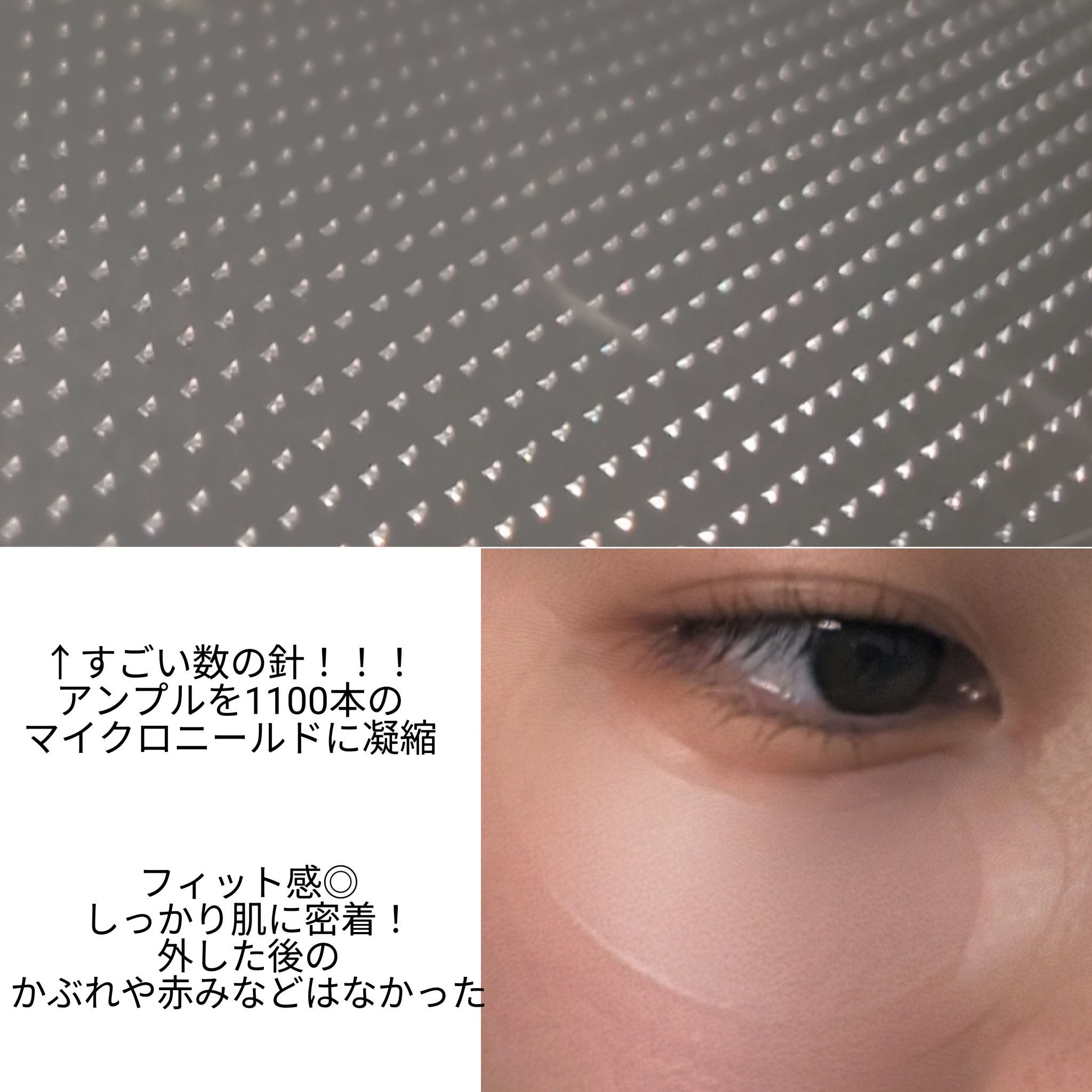 アイバックリフト1100シャットリードルパッチ/CHARDE/シートマスク・パックを使ったクチコミ（3枚目）