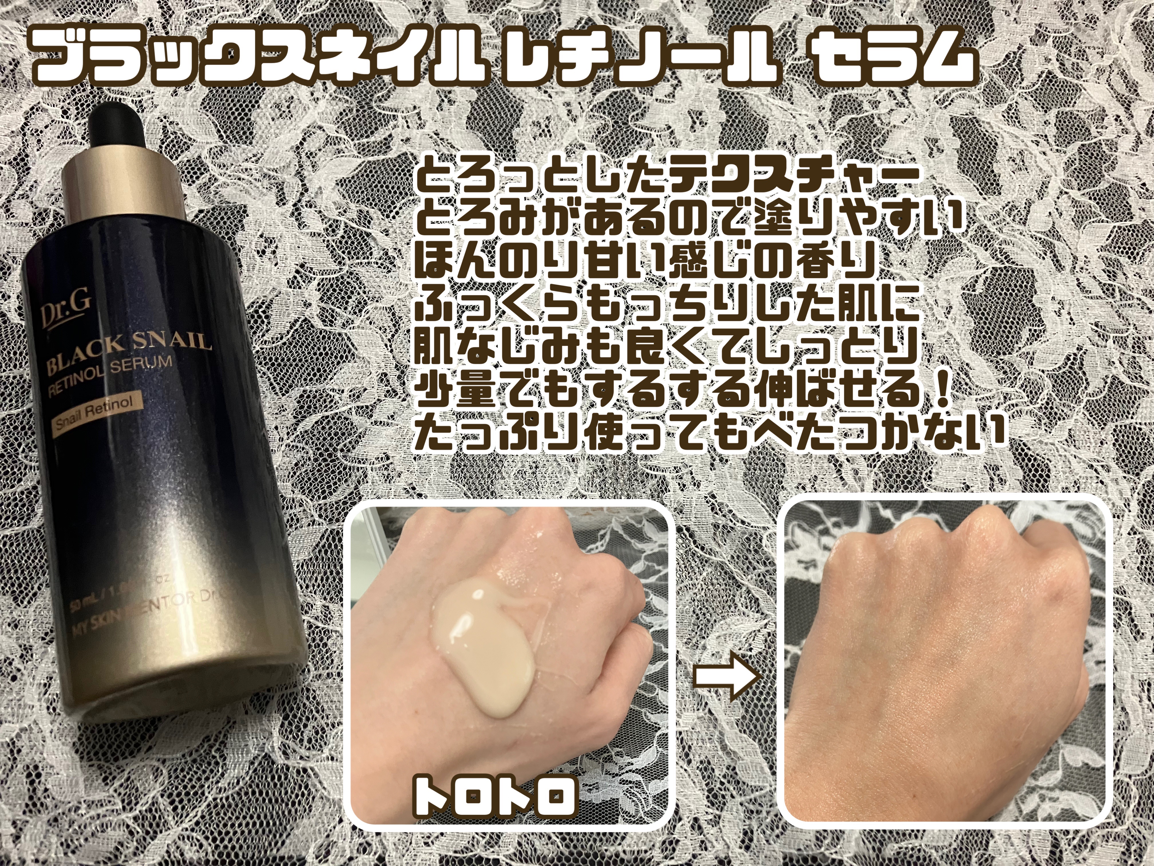 ブラックスネイル クリーム/Dr.G/フェイスクリームを使ったクチコミ（2枚目）