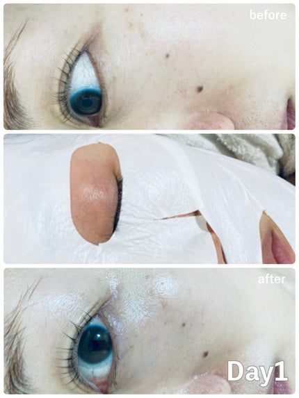 ほし⭐︎フォロバします♪(元美容部員) on LIPS 「・#購入品記録#使って良かったもの肌にコンプレックスがあるから..」(3枚目)