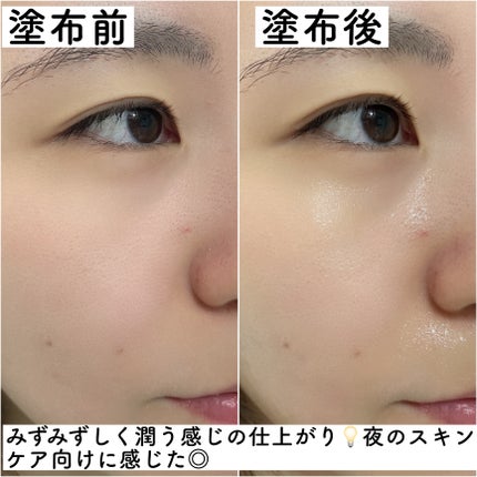 PHセンシティブアンプル/SAM'U/美容液を使ったクチコミ(5枚目)