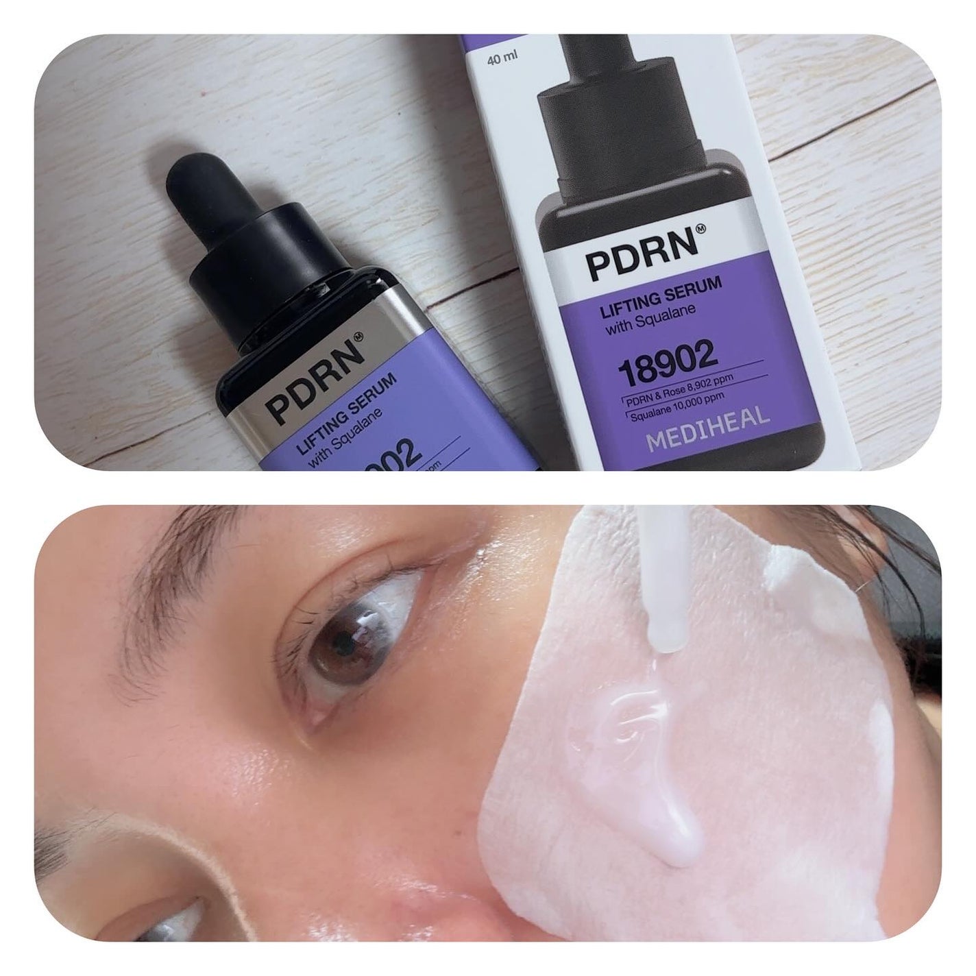 ç¿ åðŠ©ãã©ãã100 on LIPS ããPRãæäŸå
ãMEDIHEALãðâïžMEDIHEALPDR..ãïŒ3æç®ïŒ