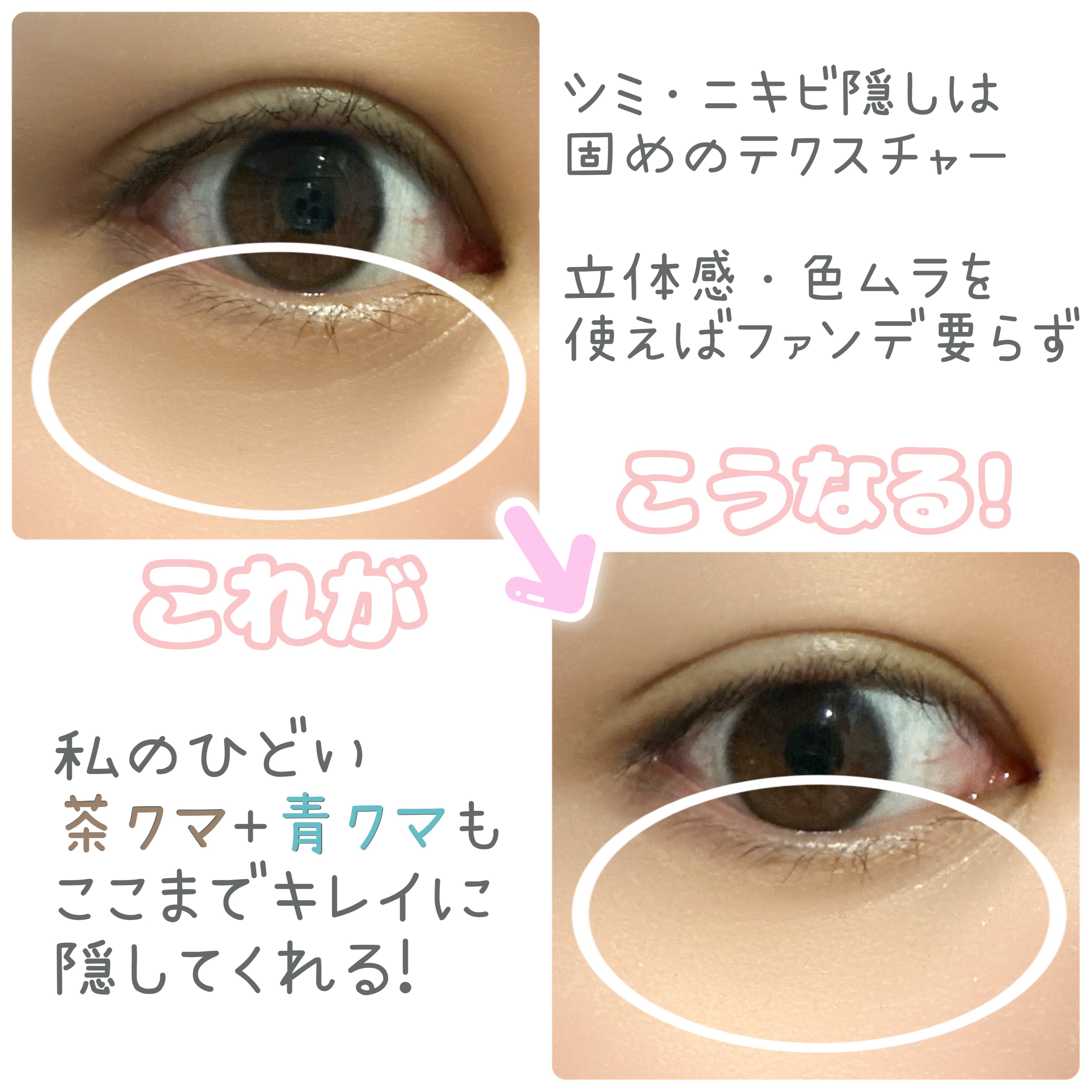 シークレットコンシーラーパレット/MilleFée/パレットコンシーラーを使ったクチコミ（3枚目）