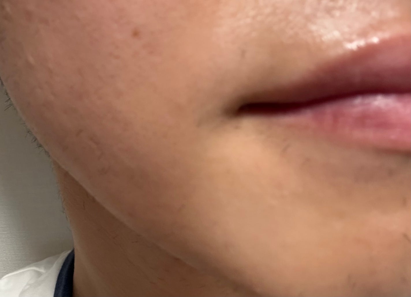 super power mask/AROCELL/シートマスク・パックを使ったクチコミ(4枚目)