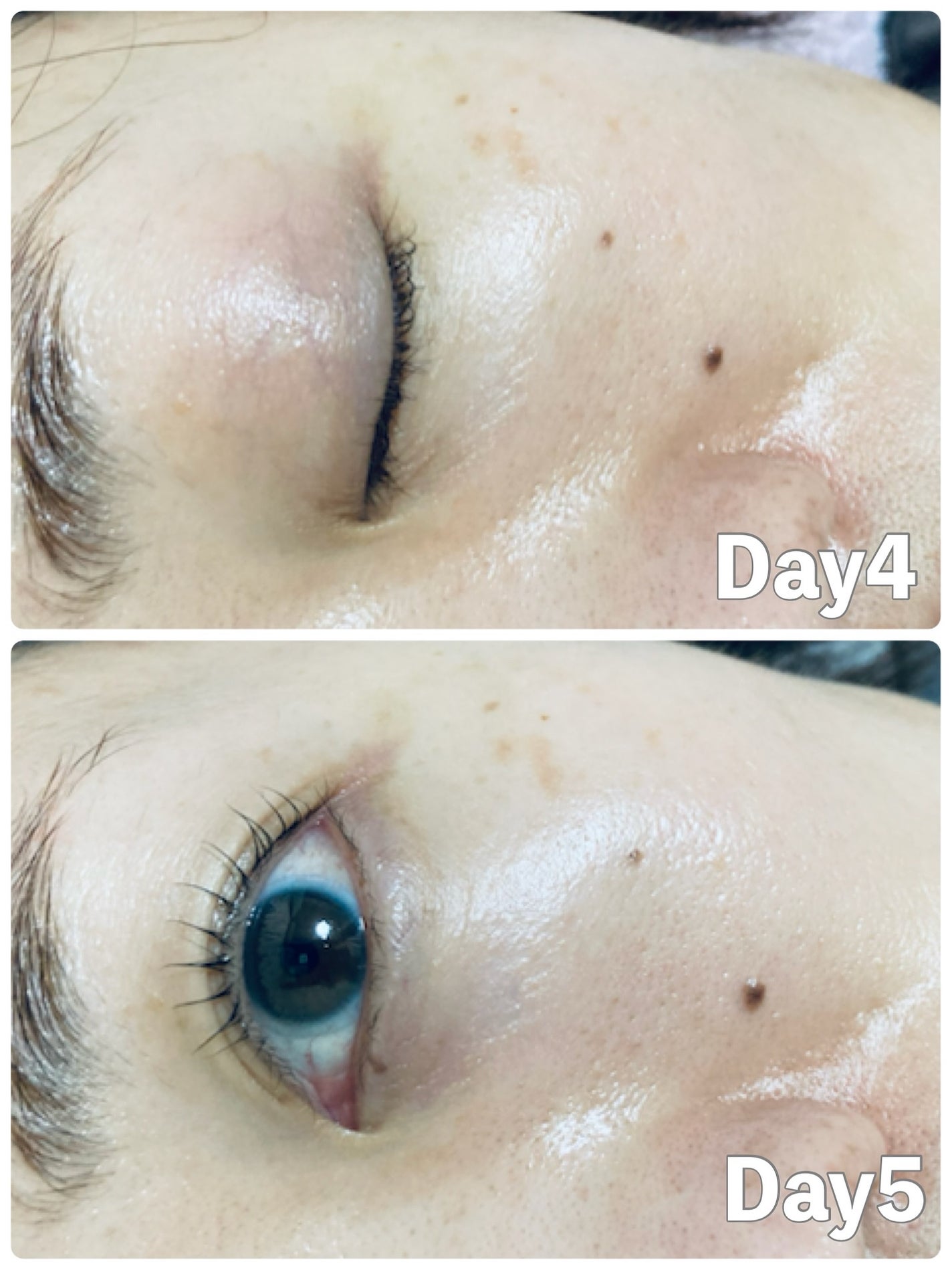 ほし⭐︎フォロバします♪(元美容部員) on LIPS 「・#購入品記録#使って良かったもの肌にコンプレックスがあるから..」(5枚目)