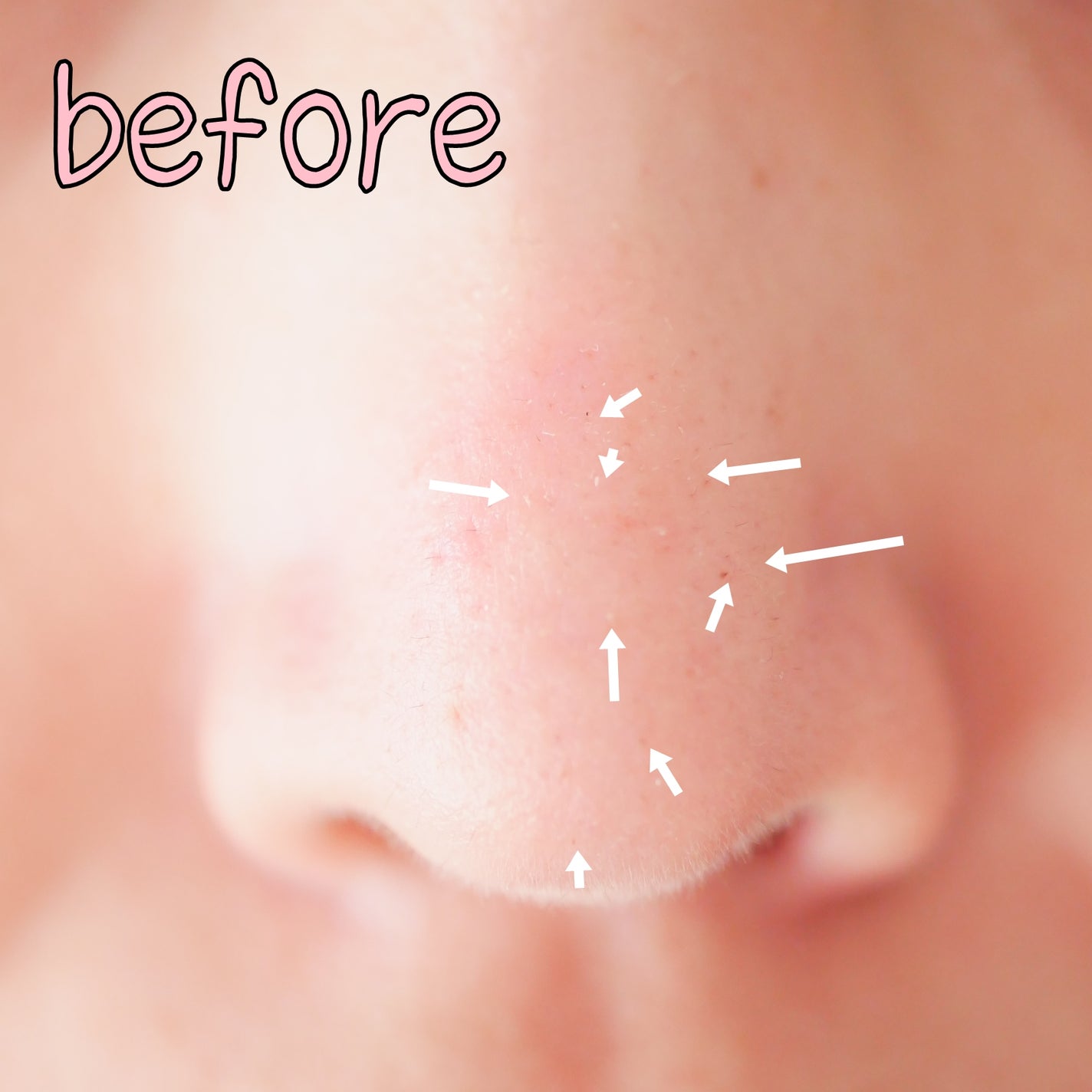 ローメルト クレンジングバーム クロ/アーレス/クレンジングバームを使ったクチコミ(6枚目)