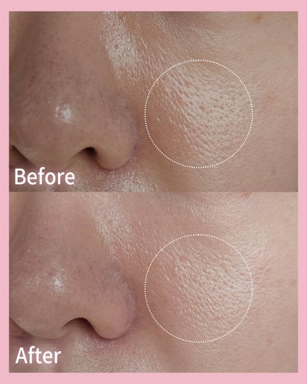 AGE20’s SIGNATURE ESSENCE COVER PACT のクチコミ「AGE20’s 
シグネチャーエッセンスカバーパクトインテンスカバー21号
& ビタシースキン.....」(3枚目)