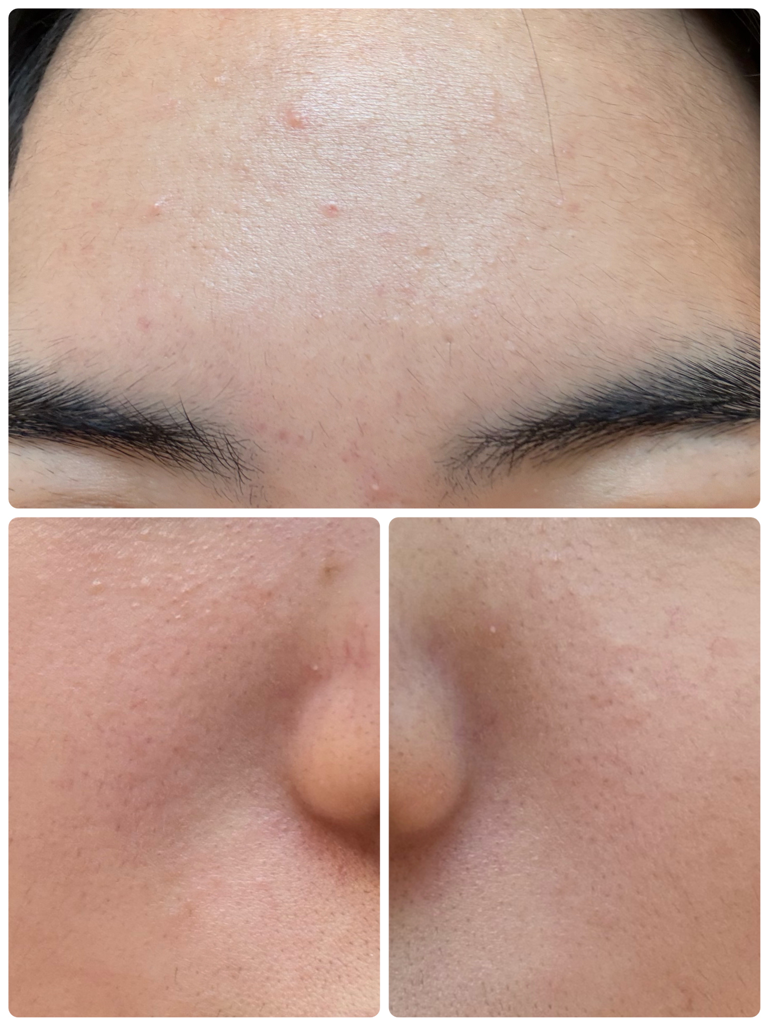 ブラックヘッドバームスクラブ/オブジェ/フェイスバームを使ったクチコミ（3枚目）